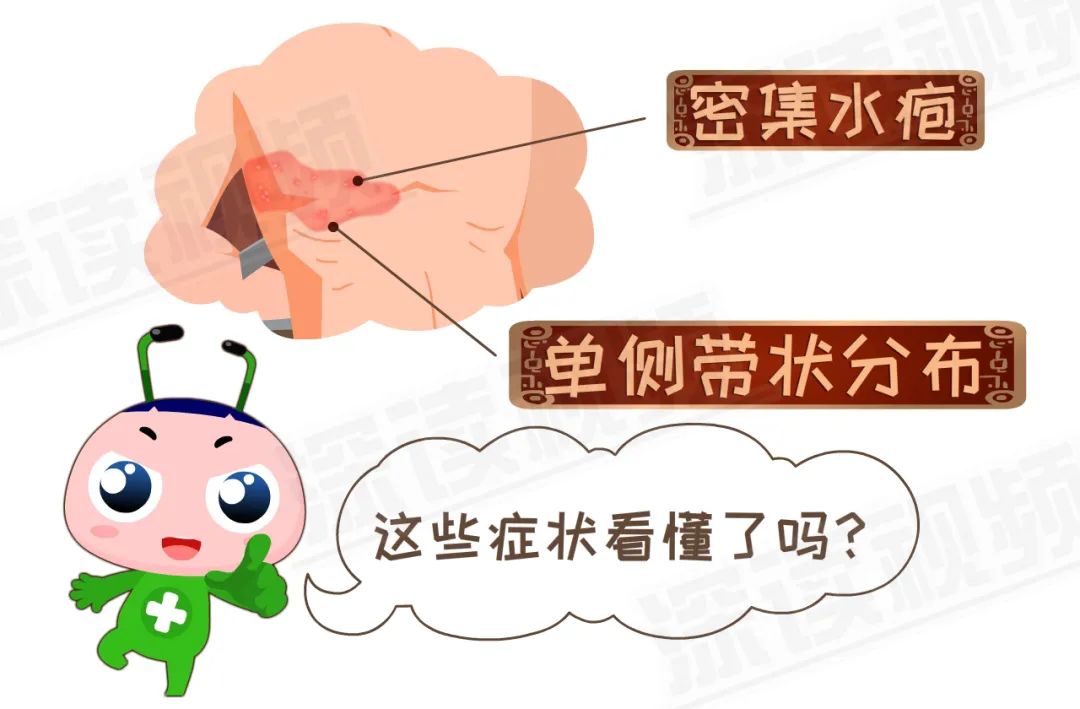 水痘病毒 带状疱疹·_病毒带状疱疹水痘几天能好_病毒带状疱疹水痘会传染吗