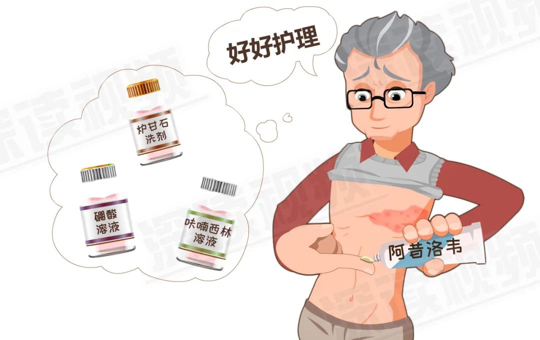 水痘病毒 带状疱疹·_病毒带状疱疹水痘会传染吗_病毒带状疱疹水痘几天能好