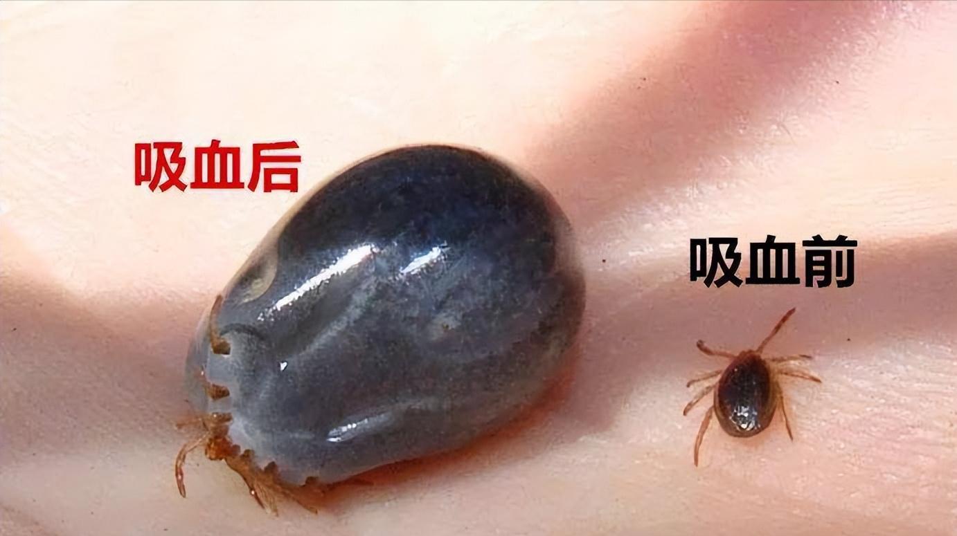 蜱虫叮咬处理方法_蜱虫的危害与预防_脾虫咬后的伤口图