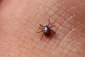 脾虫咬后的伤口图_蜱虫咬人案例_蜱虫叮咬症状