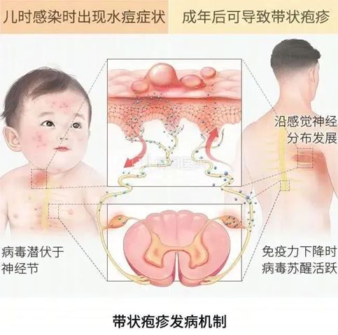 pg下载通道 这种病剧痛还会传染！北京启动接种咨询！专家提醒——