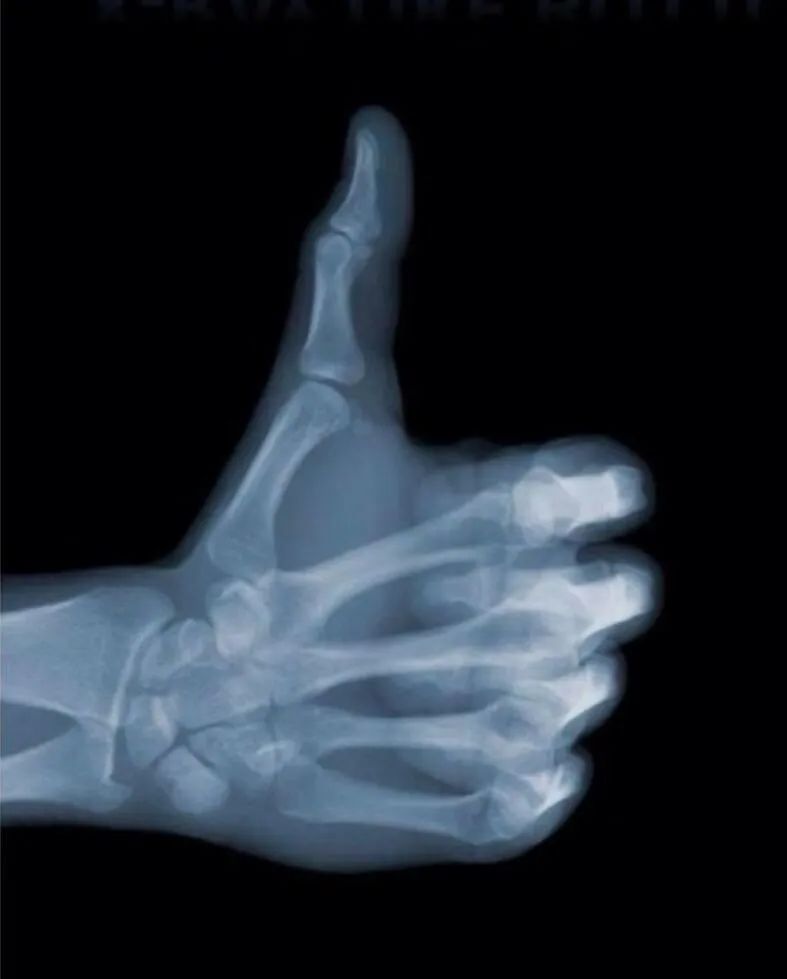 听诊器原理生活应用_镜子反射原理生活应用_应用挂载器原理