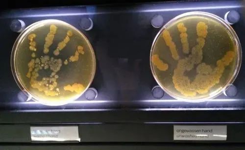 伯努利原理生活应用_听诊器原理生活应用_心脏听诊区及听诊顺序