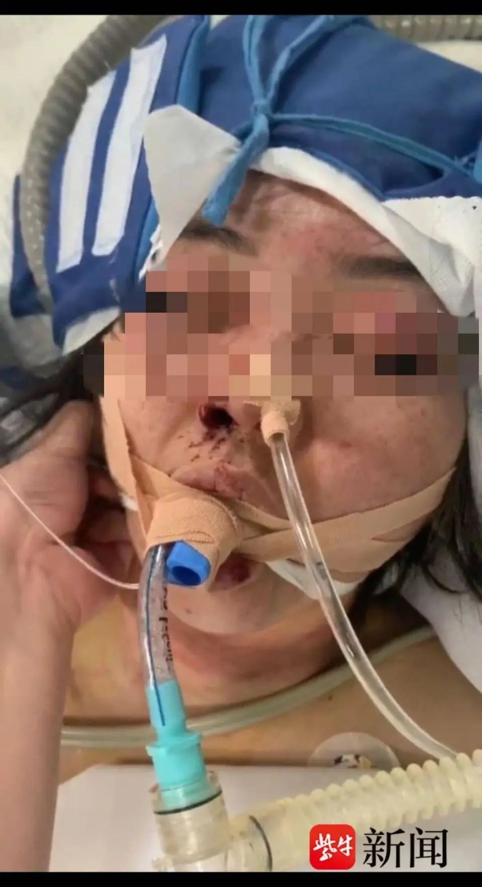 为游戏杀人新闻__ 家暴致盲案件赔偿