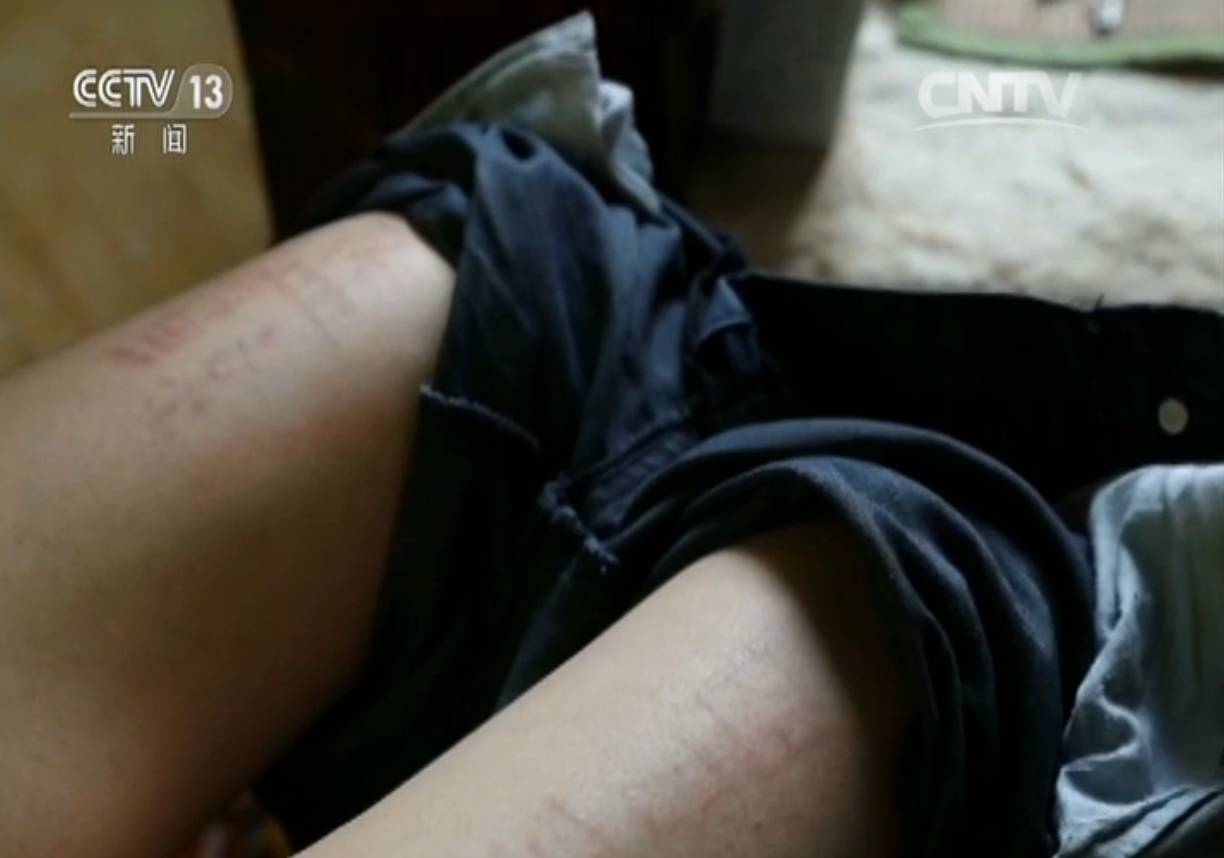 19岁少年为了完成“游戏任务”策划自杀