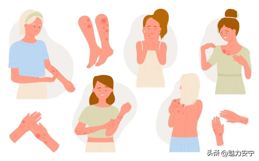 pg下载网站麻将胡了 认识水痘，保护自己和家人！