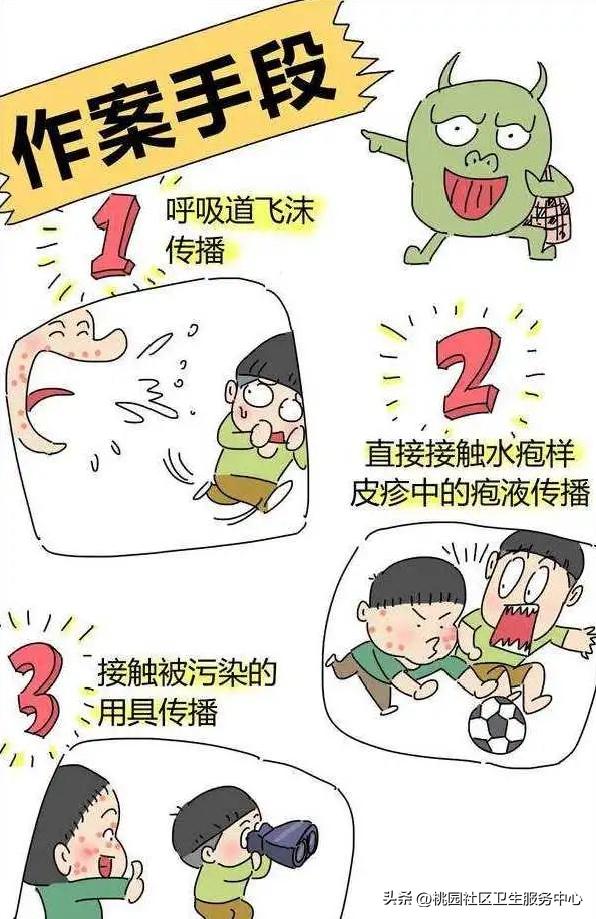 水痘预防措施_水痘疫苗接种时间_艾滋病与水痘
