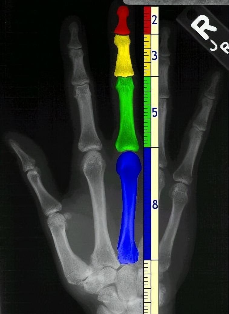 斐波那契数列生活应用_斐波那契数列在自然界中的体现_斐波那契数列与黄金分割比例