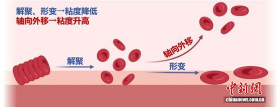 pg下载通道 如何洞察生命“内流场”？ 陕西一高校团队精准量化血液流变